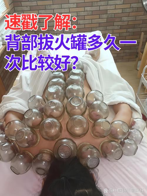 痛风可以针灸拔火罐