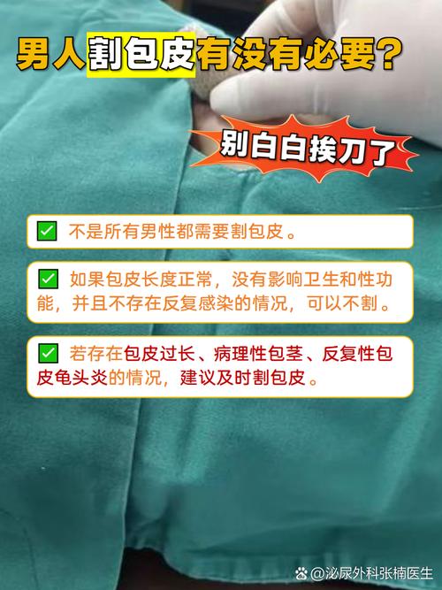 重庆割包皮男健最安全