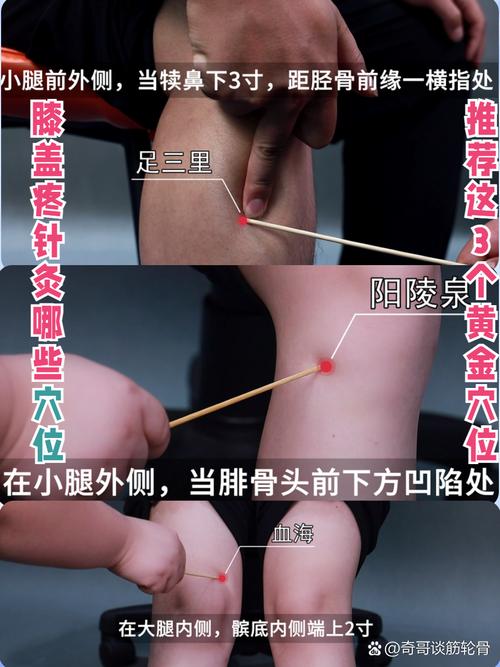 膝盖疼针灸什么穴位