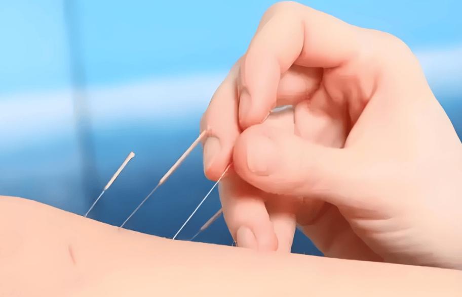 针灸按摩治疗高血压