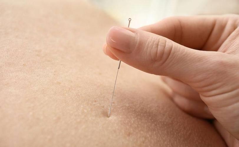 胃肠功能紊乱 针灸