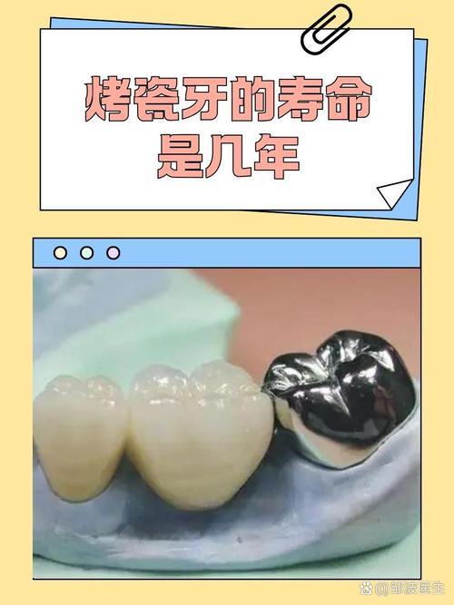 小诊所做烤瓷牙安全吗