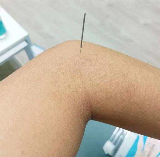 针灸治疗高血压穴位