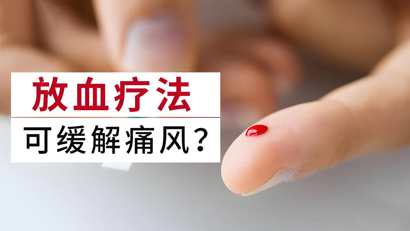痛风最快的是不是放血