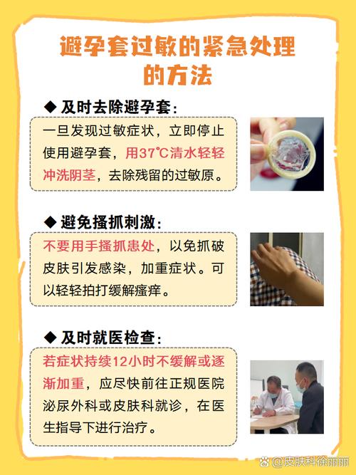 龟头对安全套过敏症状