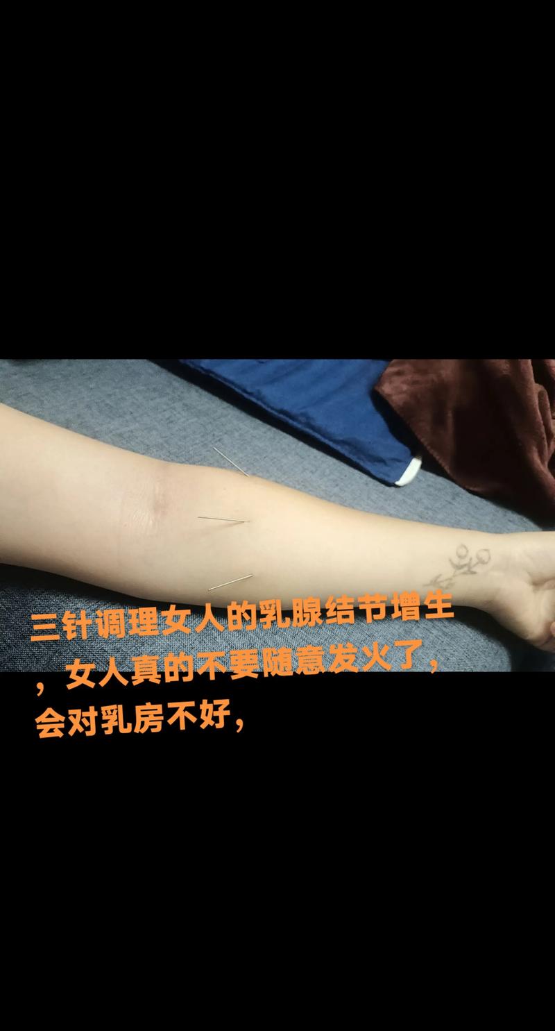 重庆哪里有针灸丰胸