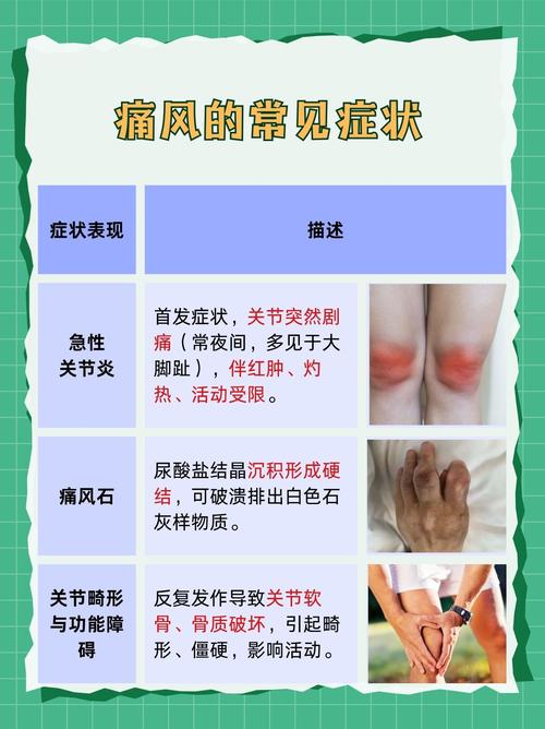 痛风急性发作快速止痛