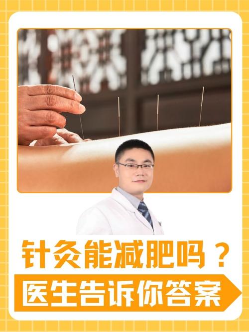 密云针灸减肥那家好