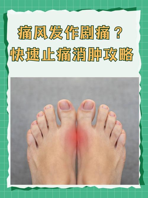 膝盖痛风如何快速消肿