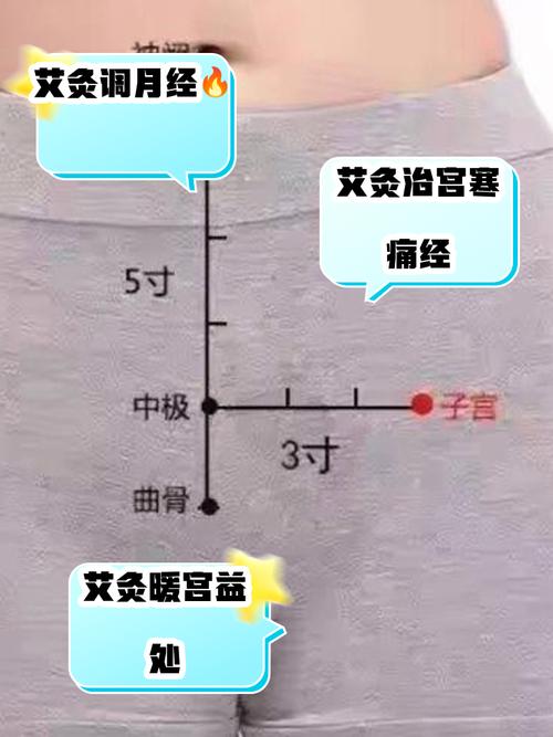 宫颈糜烂的针灸穴位