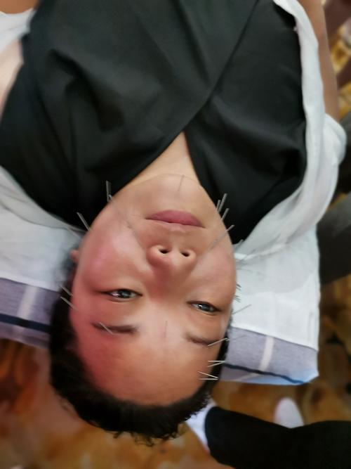 针灸推拿专业很累吗