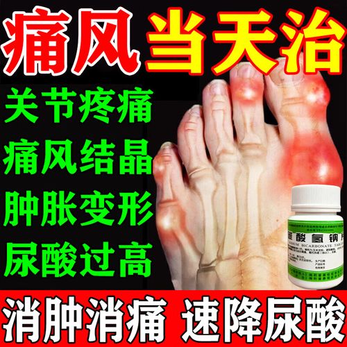 碳酸氢钠片对痛风作用