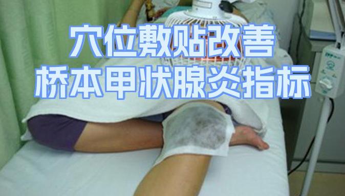 甲状腺肿大针灸治疗