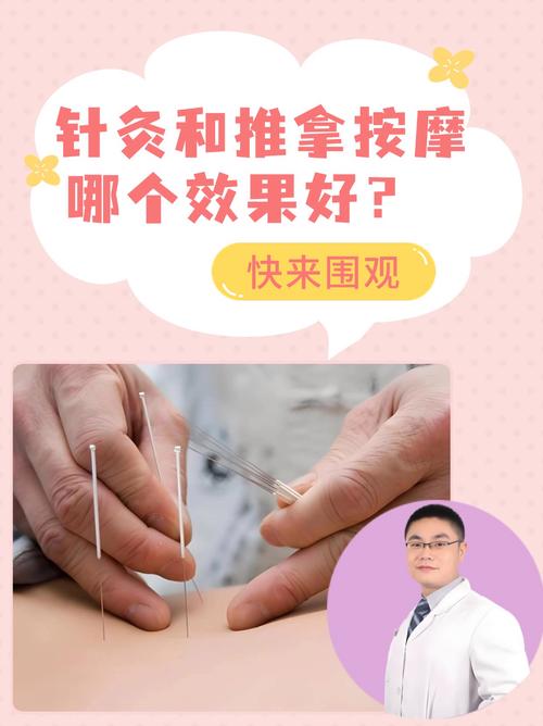 石家庄推拿针灸那有