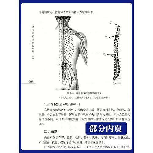 华佗夹脊可以针灸吗