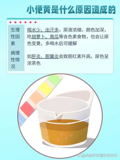 痛风小便很黄怎么回事