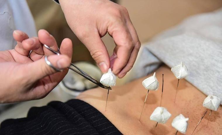 女生学中医针灸好么