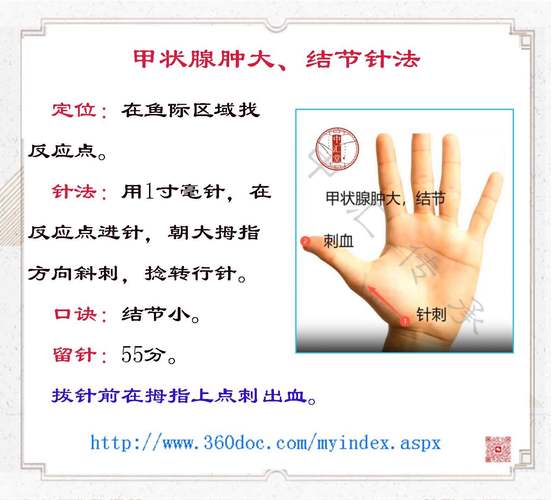 针灸治疗甲亢有效吗