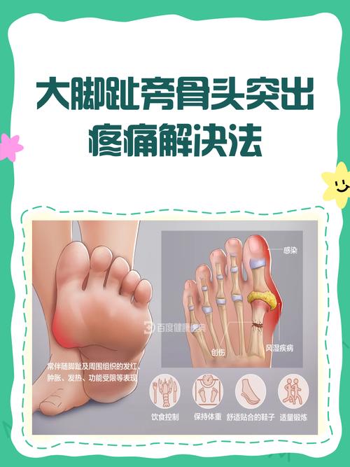 痛风脚趾变形了怎么办