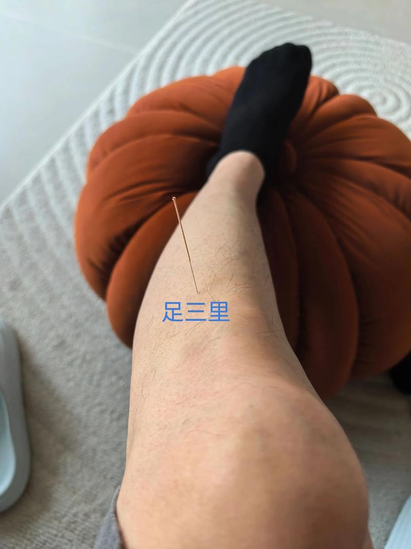 针灸调理肠胃要多久