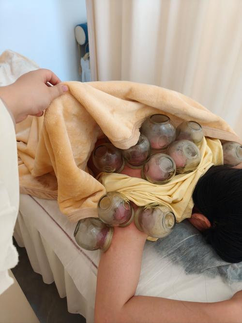 痛风可以拔罐放血疗法