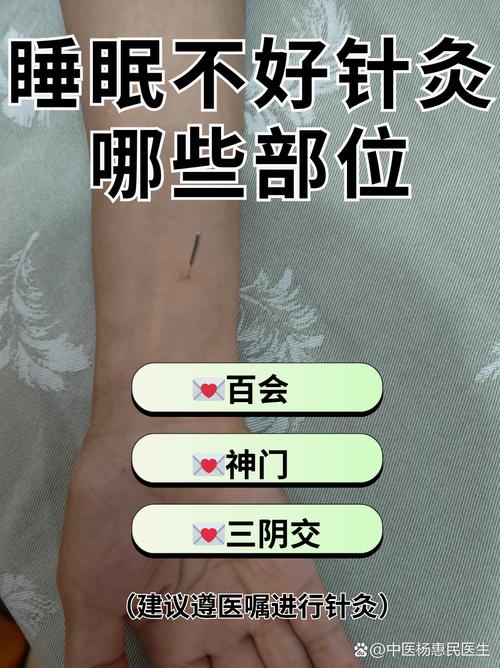 失眠用针灸哪里最好