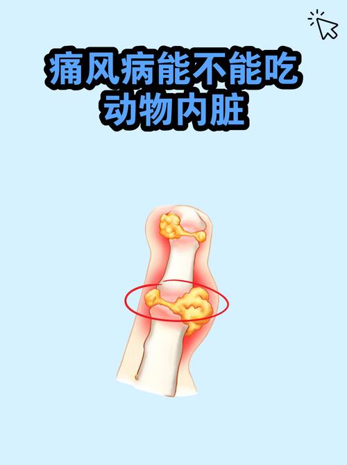 痛风尿酸高能喝咖啡吗
