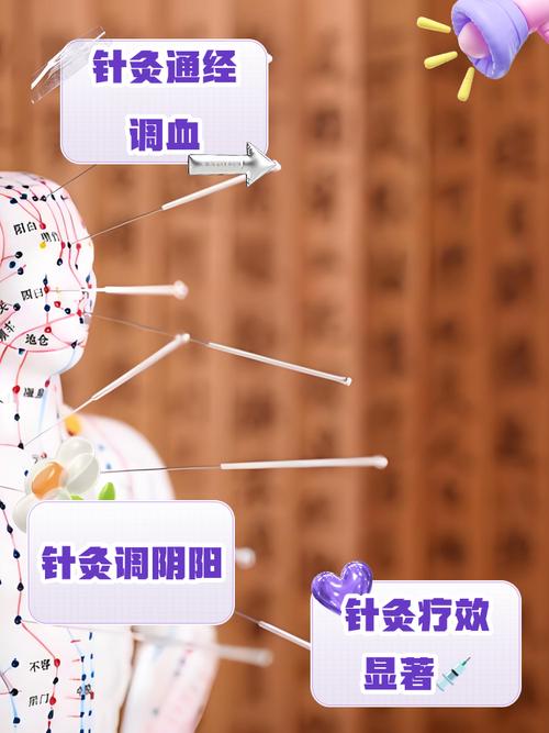 针灸背部有什么好处