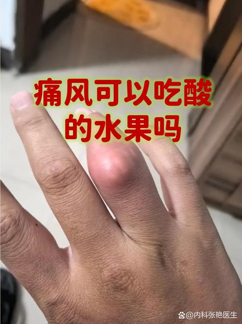 痛风患者可以吃橘子吗