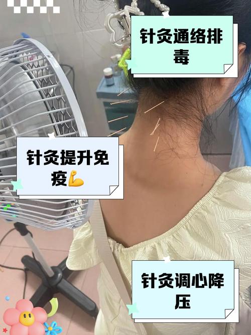 上虞针灸减肥的地方