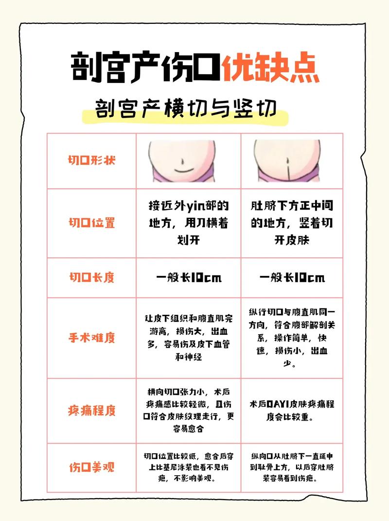 胎盘植入剖腹产安全吗