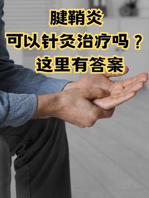 肌肉劳损可以针灸吗