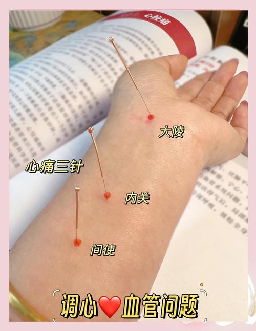 高血压针灸哪些部位