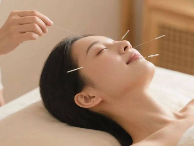 针灸可以改善肤色吗