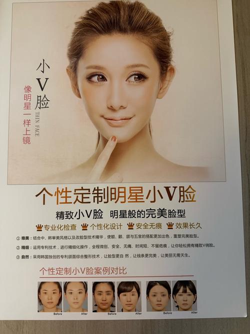 做微整形的模特安全吗