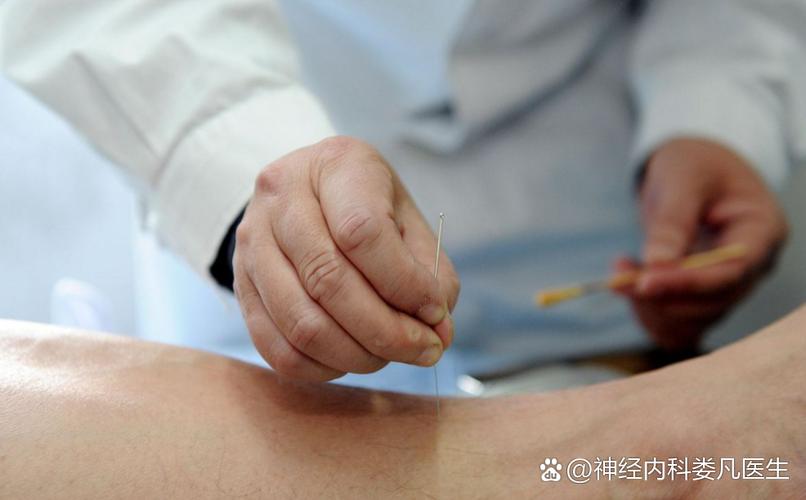 水肿针灸可以治好吗