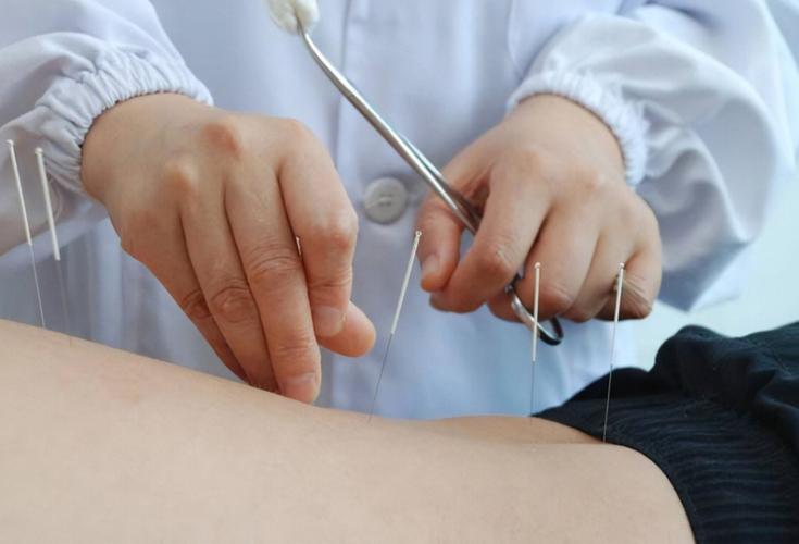 针灸后人特别容易饿