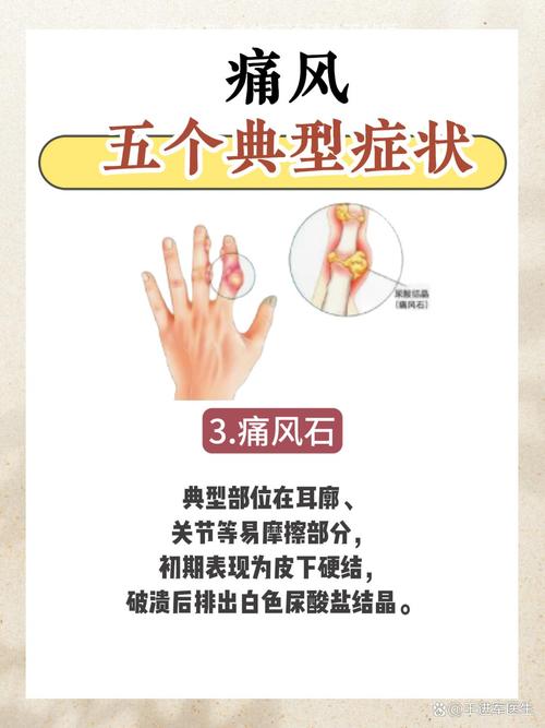 十二级疼痛排行榜痛风