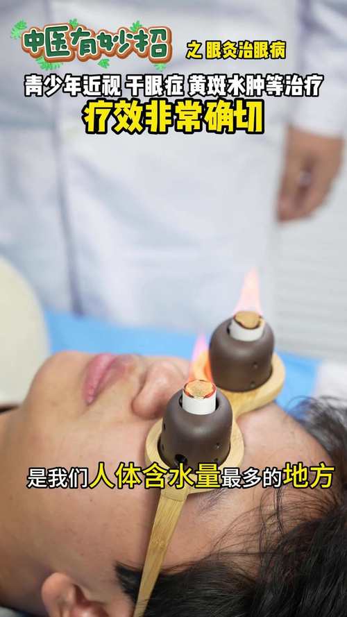 针灸可以治疗眼睛吗