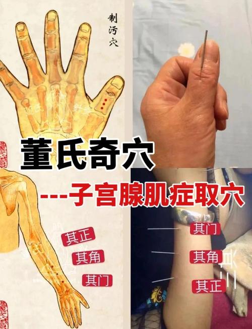 针灸调理卵巢要多久