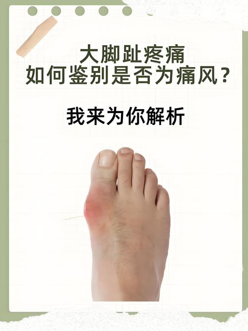 痛风是由于什么引起的