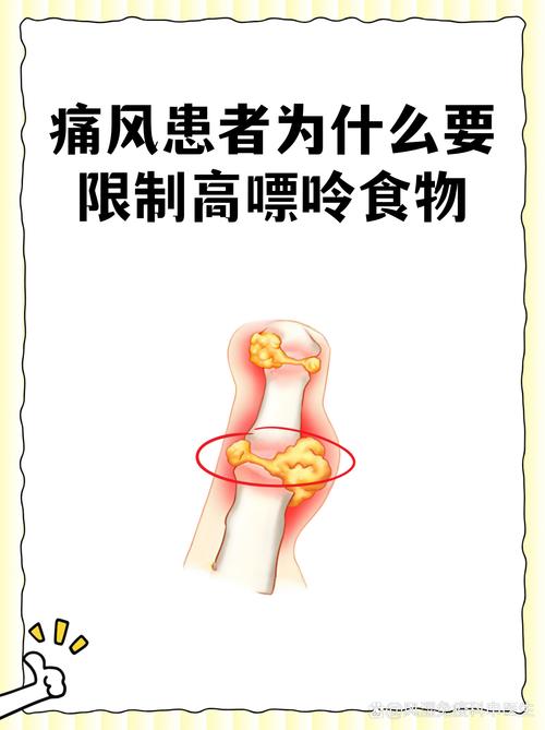 尿酸不高为啥还得痛风