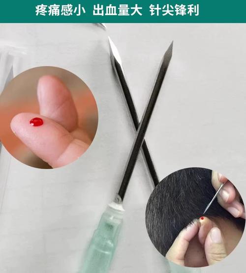 脸上长痘痘针灸放血