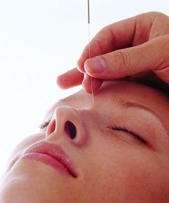 脸上长痘痘针灸放血