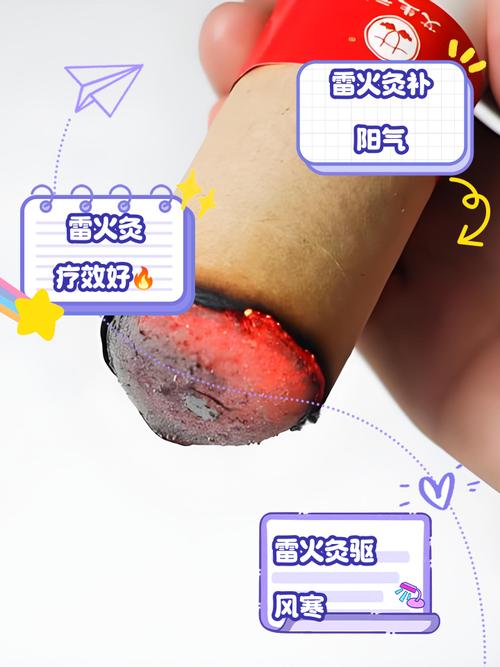 雷火针灸属于什么灸