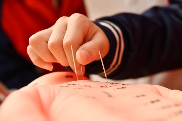 各种针灸法图片大全