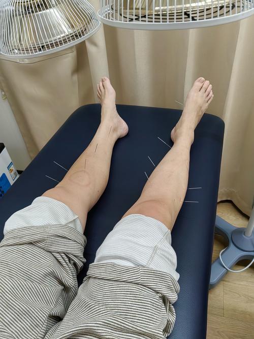 滨州专业针灸在哪里