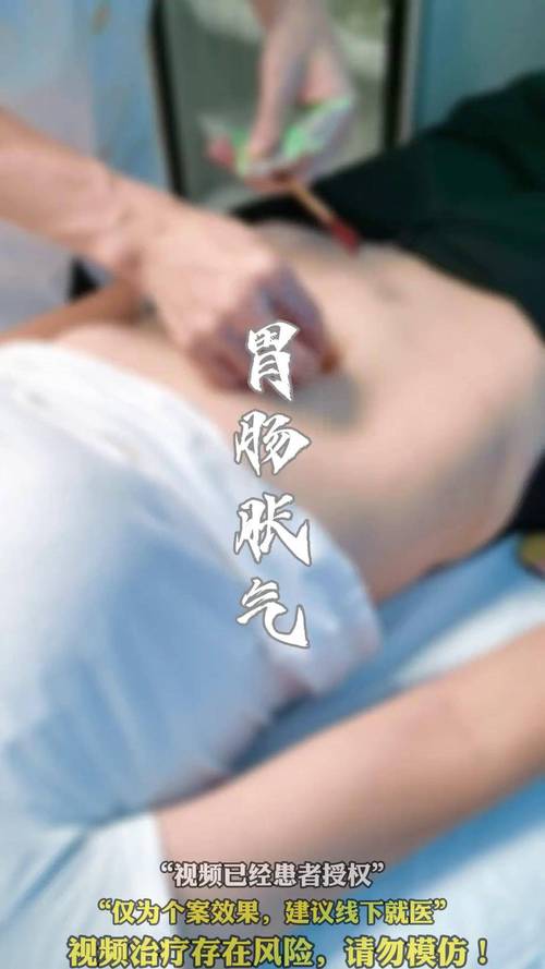 肚子胀气针灸管用吗