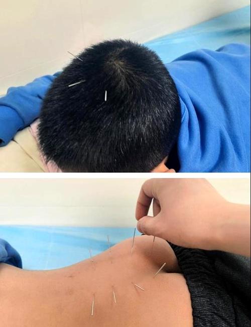 小孩尿床针灸扎哪里