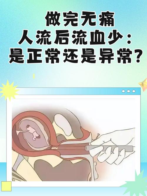 胎停做无痛人流安全吗